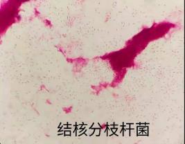 結核分枝桿菌的生物學特性、培養方法及應用
