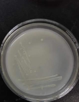 解磷菌是什么菌？解磷微生物種類(lèi)及分布
